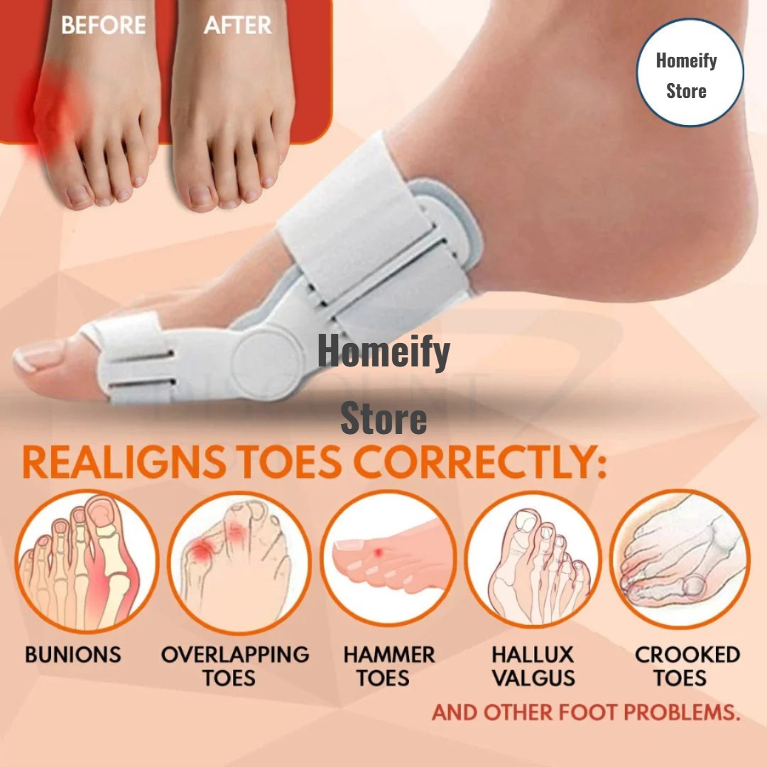 (Free Home Delivery) Pain Relief Bunion Toe Corrector - (IMPORTED W/O KNOB)
